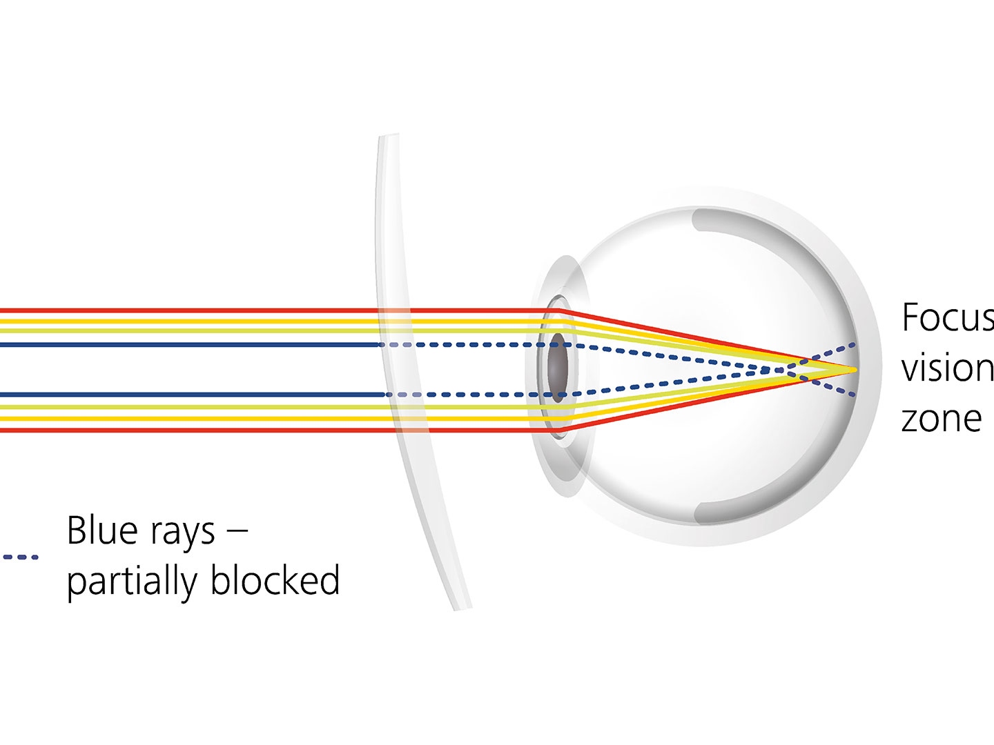 Visualisation of how lens coatings can reduce glare by partially blocking blue rays 